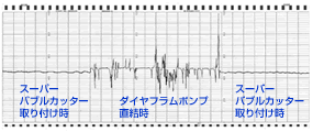 使用時と未使用時